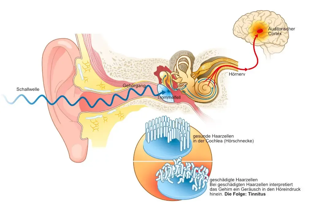 Vom Ohr ins Gehirn