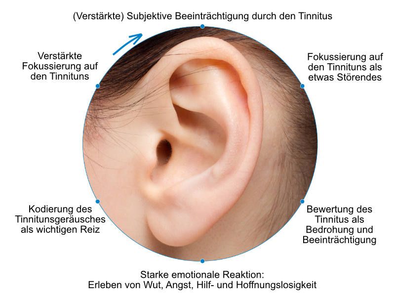 Tinnitus Noiser